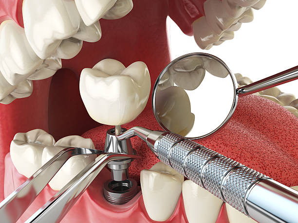 Best Emergency Dental Services for Seniors in Tolar, TX
